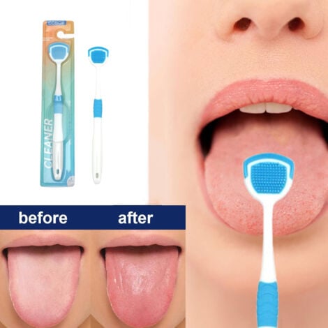 Tongue Cleaner Brush With Soft Silicone Bristles – Oral Hygiene Tool For Fresh Breath & Bacteria Removal – Tongue Cleaner – Tongue Scraper – Bad Breath Remover